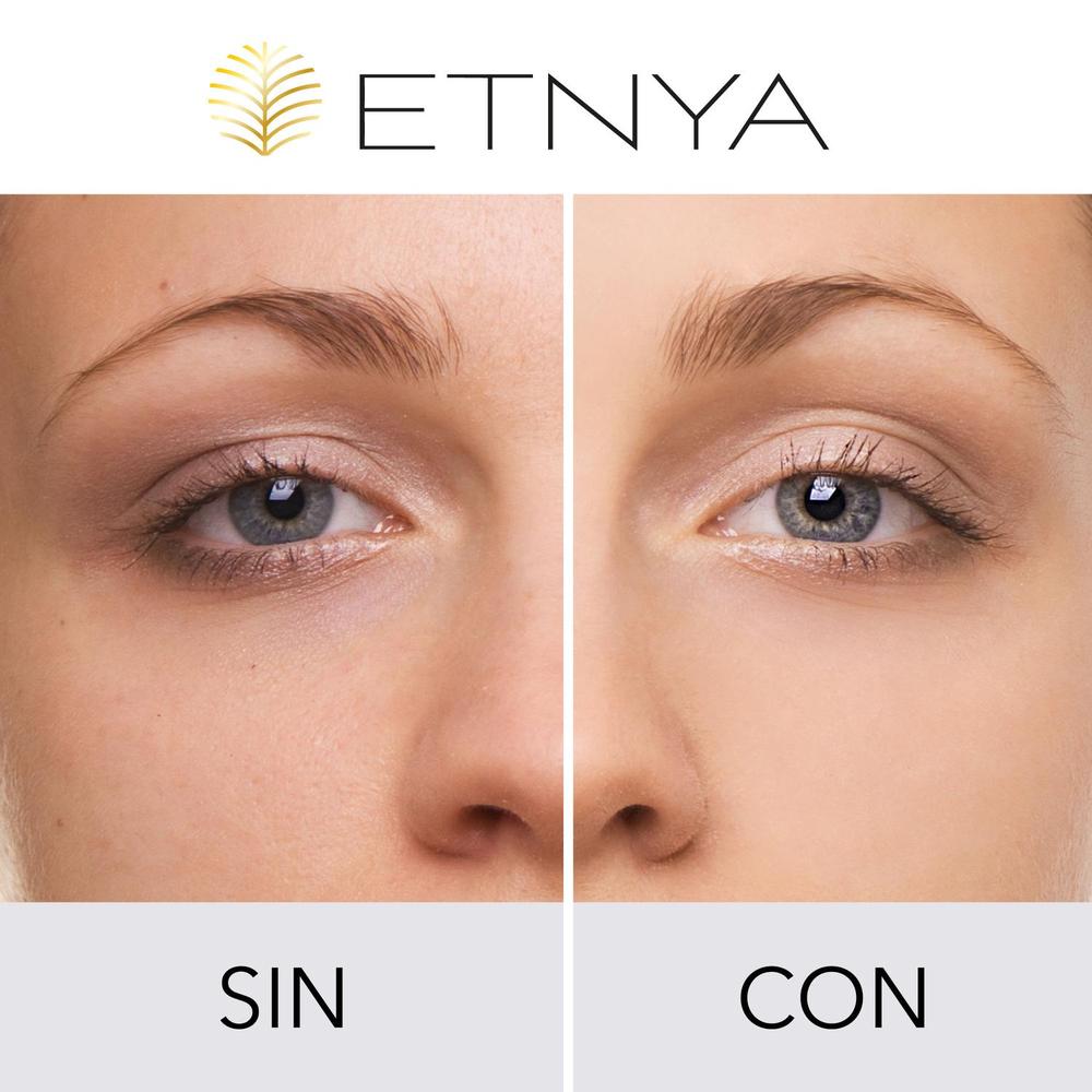 Botox Reparacion Natural Efecto Instantaneo Duracion 6 Hrs